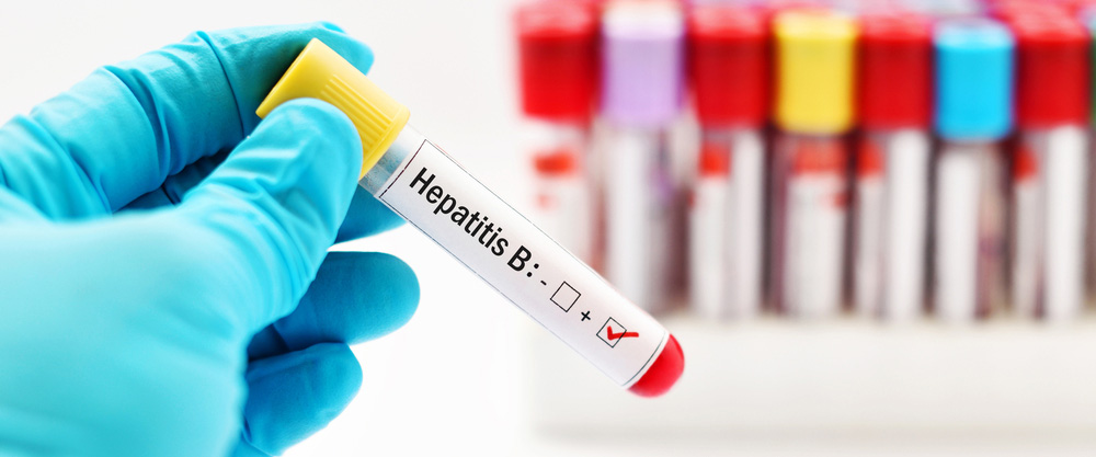 Čo je hepatitída B? Aké sú príznaky a metódy liečby?